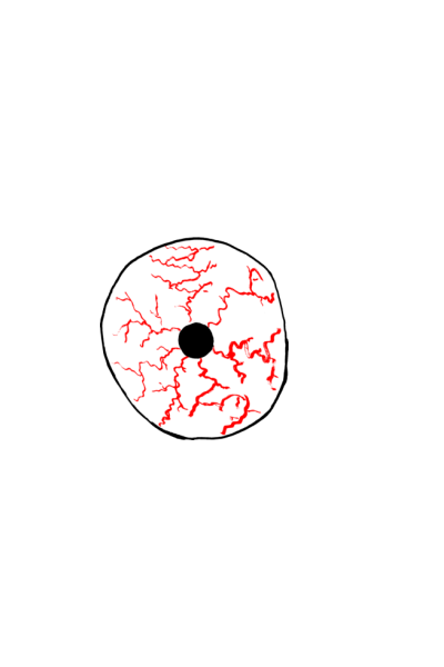 Oko